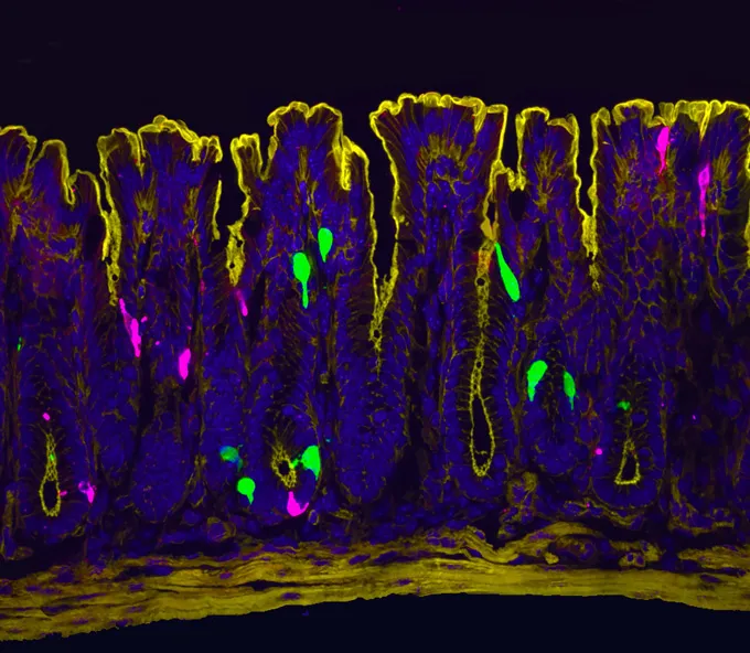slice of a piece of mouse colon